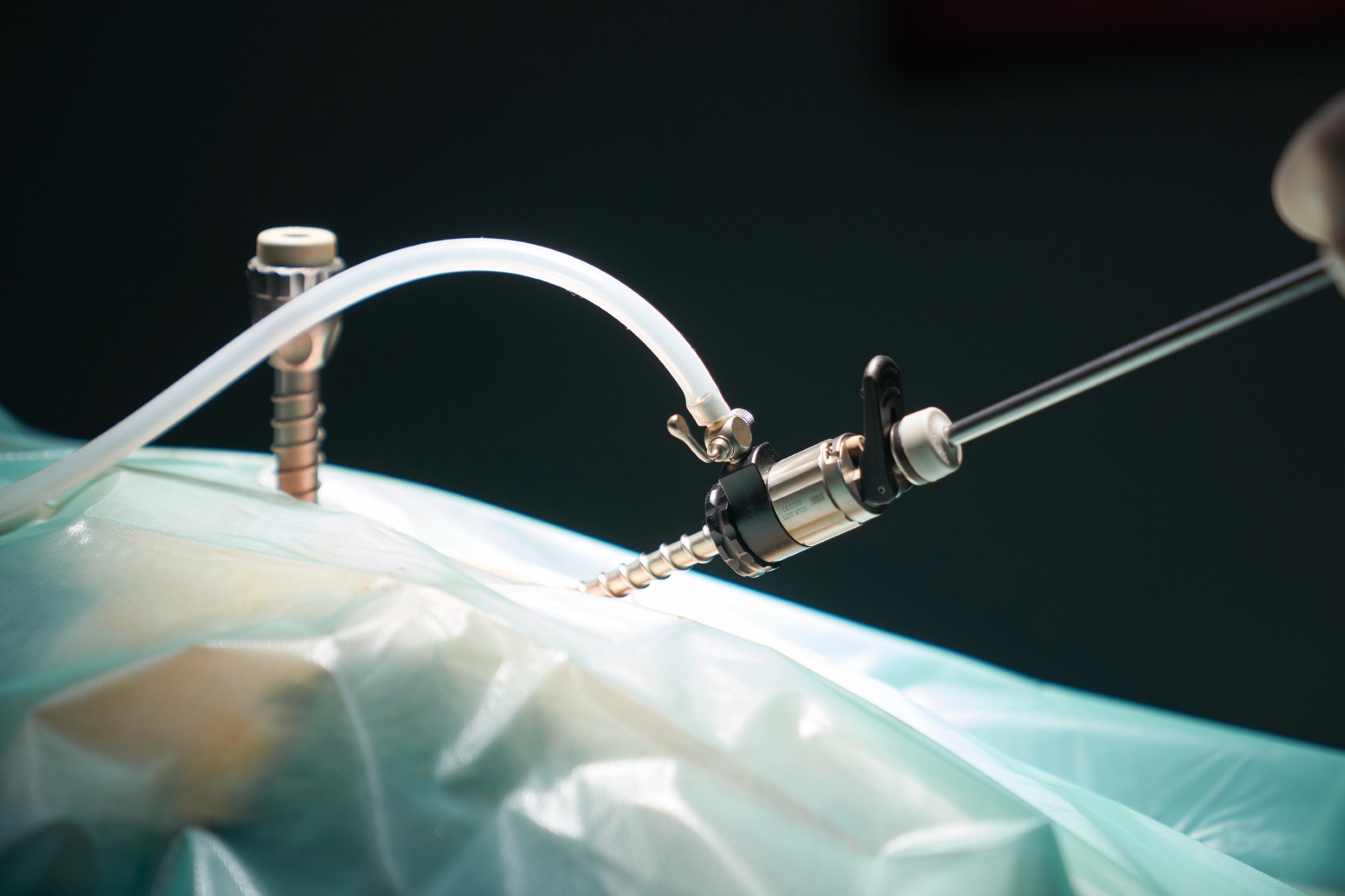 Laparoscopic Services